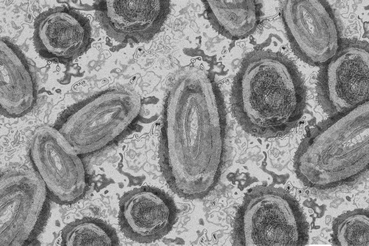 Neues Virus in Frankreich: Bis zu 50 Prozent der Infizierten sterben