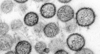 WHO: Hantavirus auf Schiff wurde von Mensch zu Mensch übertragen